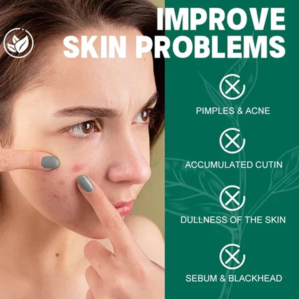 SOME BY MI AHA-BHA-PHA 30-Dage - Night Cream recensie en prijs
